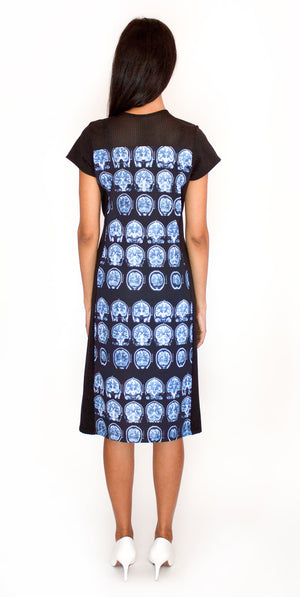 Brain Scan MRI Dress